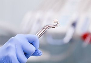 Gloved hand holding a tooth with forceps