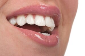 Close up of woman’s teeth